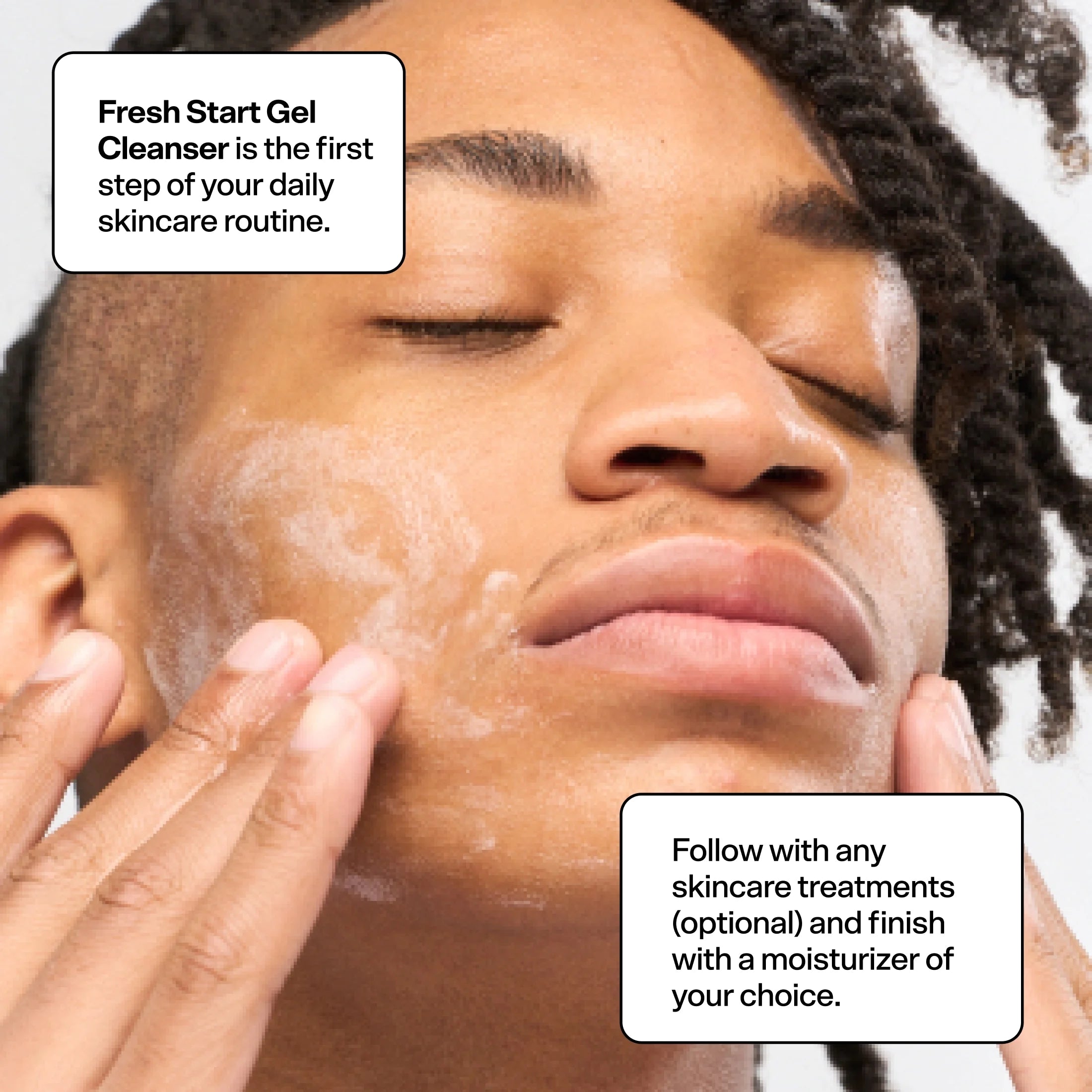 Acne Kit, 3 Items V6815