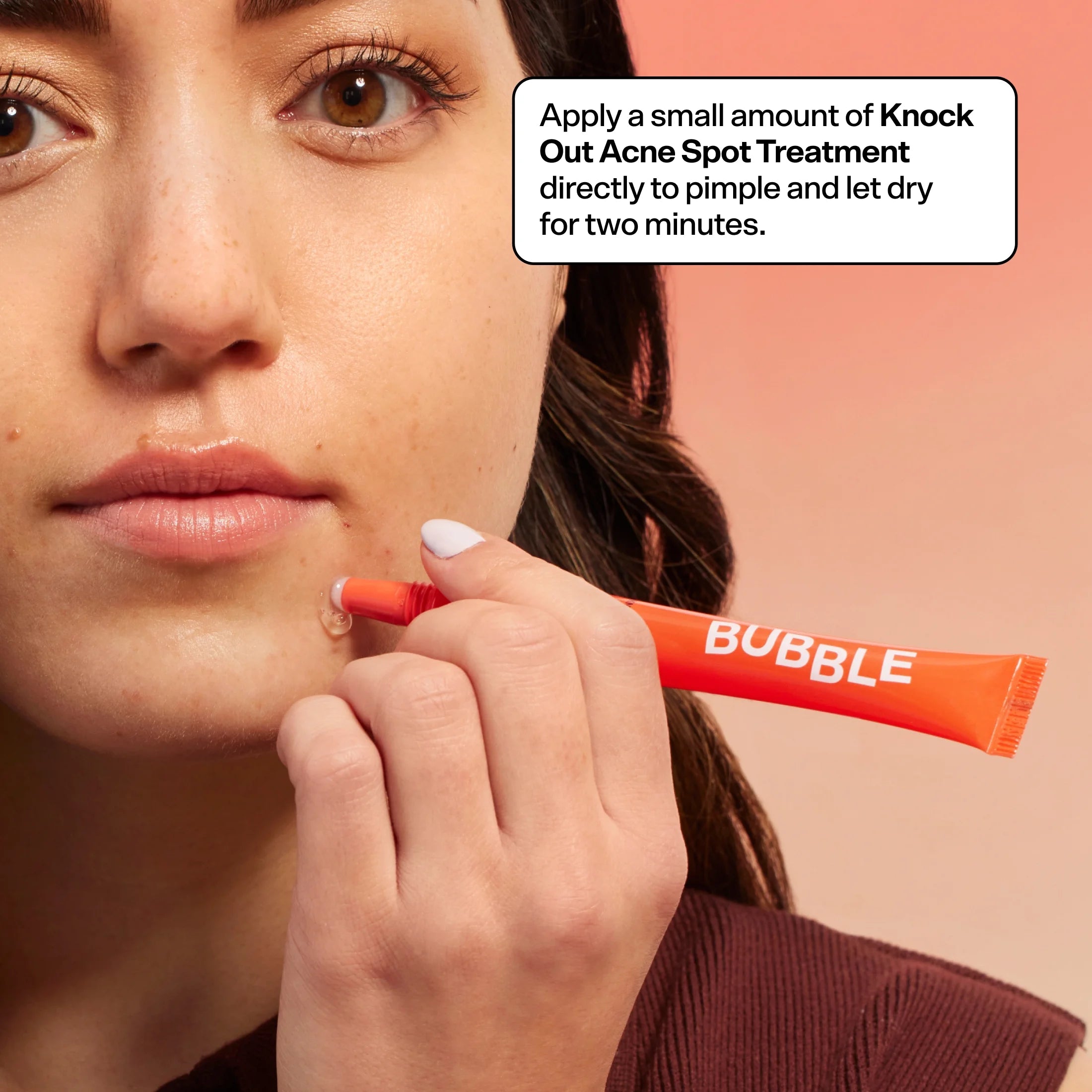 Acne Kit, 3 Items V6815