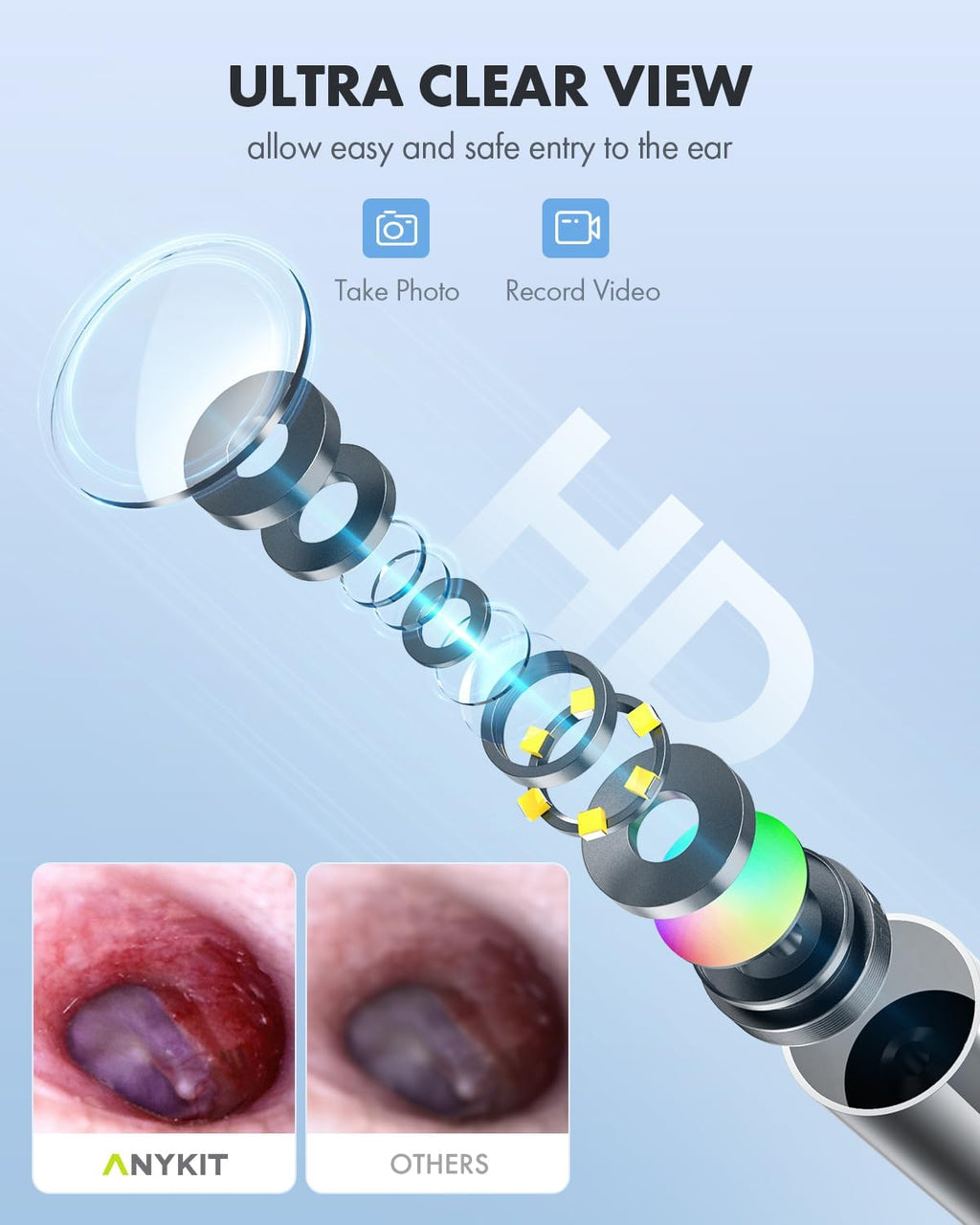HD Ultra Clear View Ear Wax Removal Tool Otoscope with Ear Spoon Q3872